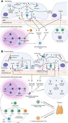 Frontiers | Membranous nephropathy: Clearer pathology and